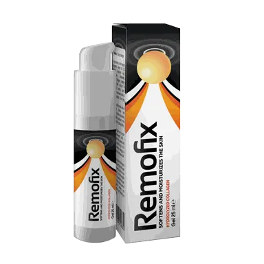 Remofix — fotografia